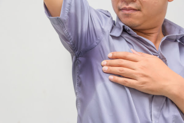 excessive-sweating